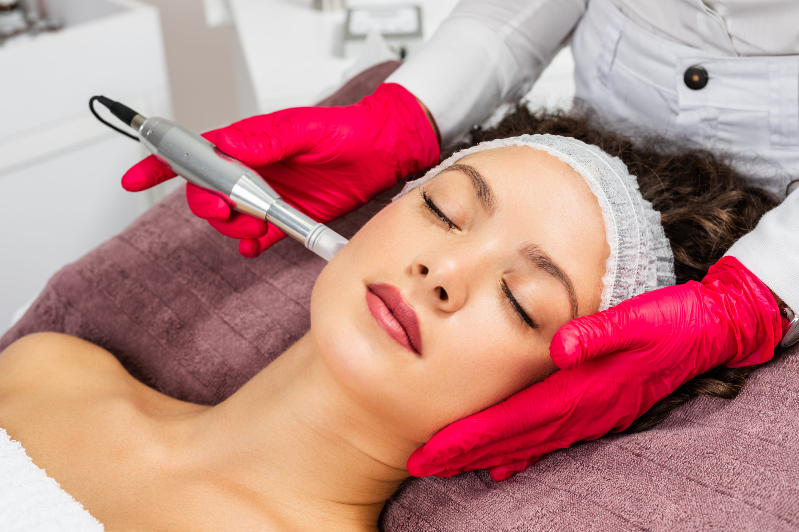 Micropen Treatment | Ella Medical Aesthetics