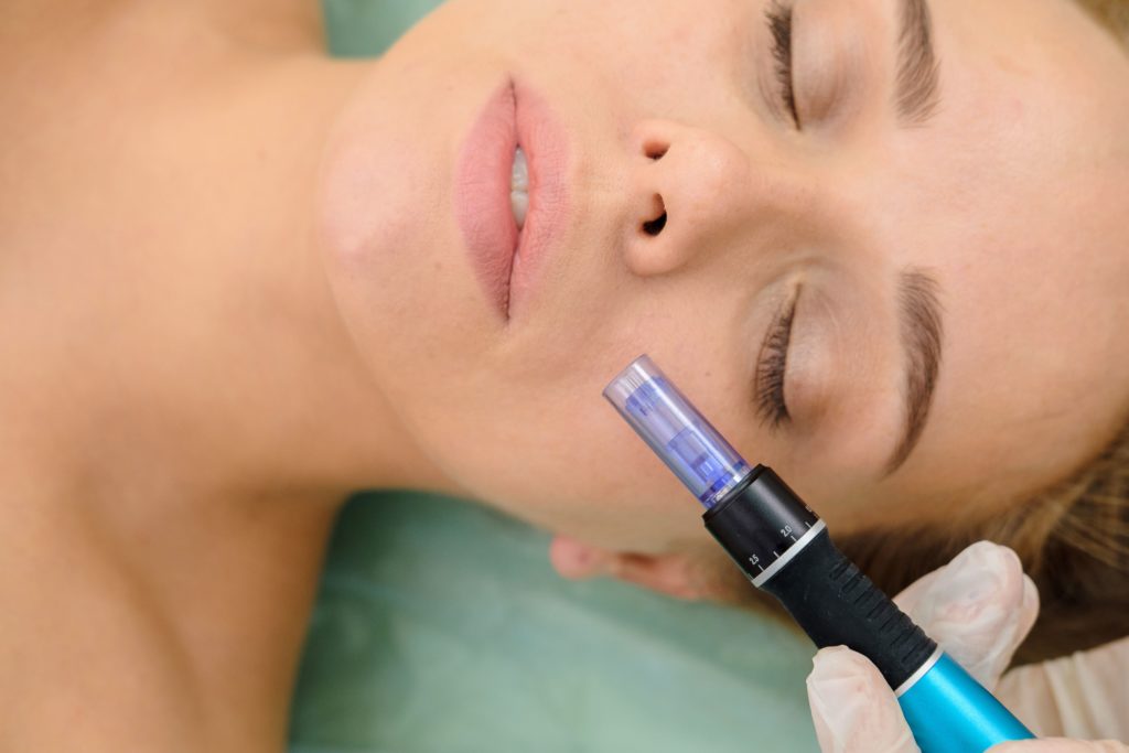 MICROPEN | Ella Medical Aesthetics