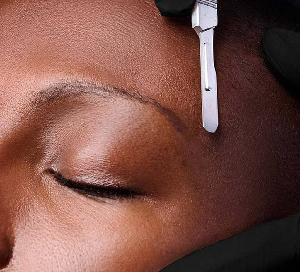 Dermaplaning in Austin, TX